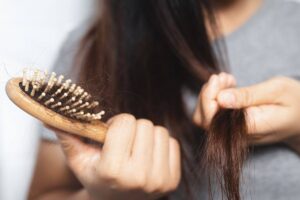 Ragazza nota perdita di capelli nella spazzola