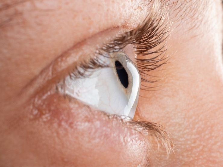 Verifica medica della cornea