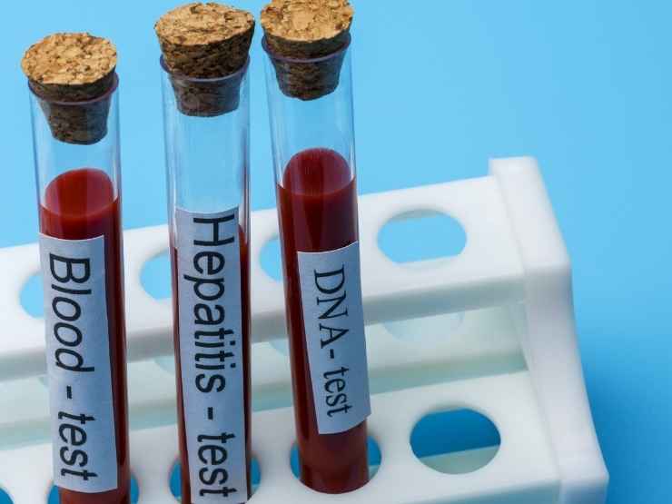 I test per l'epatite