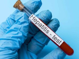 Test per l'epatite
